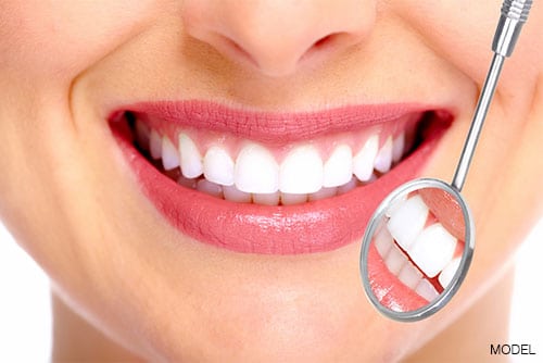 Your Cosmetic Dentist for Porcelain Veneers in San Francisco