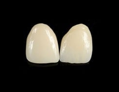 porcelain crowns and veneers