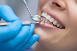 Dentist examining a patient teeth in the dentist-img-blog