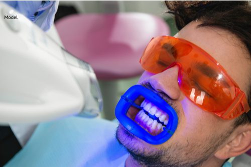teeth whitening procedure-img-blog