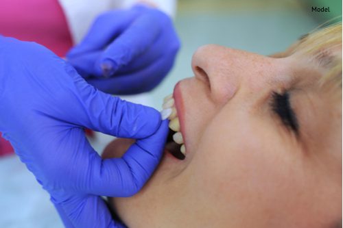 dentist puts dental veneers patient and correction of teeth