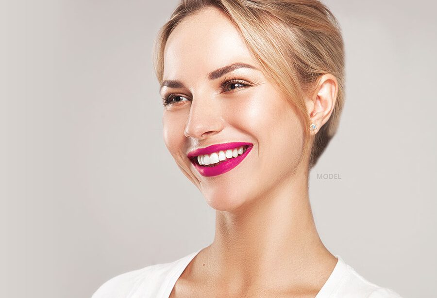 smile makeover model